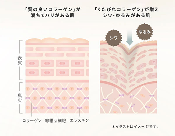 コラーゲン